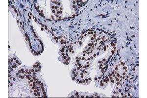 Image no. 1 for anti-CTD (Carboxy-terminal Domain, RNA Polymerase II, Polypeptide A) Small Phosphatase 1 (CTDSP1) antibody (ABIN1497679) (CTDSP1 抗体)