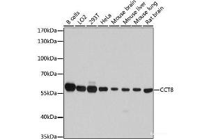 Western blot analysis of extracts of various cell lines using CCT8 Polyclonal Antibody at dilution of 1:7000. (CCT8 抗体)