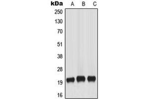 Western blot analysis of MART-1 expression in HeLa (A), A431 (B), WERI (C) whole cell lysates. (MLANA 抗体  (Center))