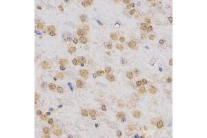 Immunohistochemistry (IHC) image for anti-Histone 3 (H3) (H3K36me3) antibody (ABIN3016039)