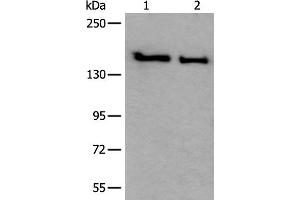 Western blot analysis of HUVEC and Jurkat cell lysates using SMC1A Polyclonal Antibody at dilution of 1:300 (SMC1A 抗体)
