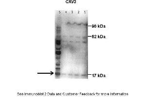 Lanes:   Lane1: 50 ug human placental tissue lysate Lane2: 40 ug human placental tissue lysate Lane3: 30 ug human placental tissue lysate Lane4: 20 ug human placental tissue lysate Lane5: 20 ug human myometrial tissue lysate  Primary Antibody Dilution:   1:500  Secondary Antibody:   Goat anti-rabbit HRP  Secondary Antibody Dilution:   1:10000  Gene Name:   Caveolin 3  Submitted by:   Hiten Mistry, Ania Czajka and Marta Hentschke Ribeiro, King's College London (Caveolin 3 抗体  (N-Term))
