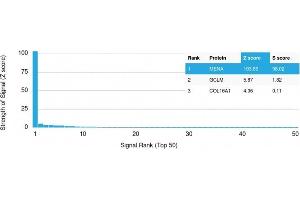 Analysis of Protein Array containing more than 19,000 full-length human proteins using ENAH / MENA Mouse Monoclonal Antibody (ENAH/1988) Z- and S- Score: The Z-score represents the strength of a signal that a monoclonal antibody (Monoclonal Antibody) (in combination with a fluorescently-tagged anti-IgG secondary antibody) produces when binding to a particular protein on the HuProtTM array. (ENAH 抗体  (AA 485-589))