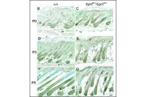 IHCdetection of SGK3 protein on the paraffin sections of the WT (left) and YPC (right) mice at P0 (B and C), P3 (D and E), and P5 (F and G) skin.