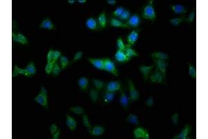 Immunofluorescence staining of HepG2 cells with ABIN7159324 at 1:100, counter-stained with DAPI. (MMGT1 抗体  (AA 66-131))