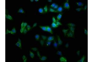 Immunofluorescence staining of HepG2 cells with ABIN7159324 at 1:100, counter-stained with DAPI.
