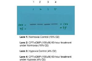 TRPC6 antibody - middle region  validated by WB using pulmonary artery smooth muscle