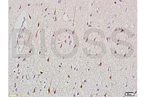 Formalin-fixed and paraffin embedded: rat brain tissue labeled with Anti-CK2 Polyclonal Antibody (ABIN730813), Unconjugated at 1:200, followed by conjugation to the secondary antibody and DAB staining (Keratin 2 抗体  (AA 535-638))