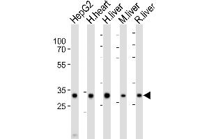 Western blot analysis of lysates from HepG2 cell line, human heart, human liver, mouse liver, rat liver tissue lysate (from left to right), using DECR1 Antibody (Center) (ABIN6243564 and ABIN6577825). (DECR1 抗体  (AA 241-274))