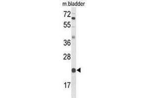 Western blot analysis of DGCR6 Antibody (Center) in mouse bladder tissue lysates (35µg/lane). (DGCR6 抗体  (Middle Region))