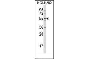 Western blot analysis in NCI-H292 cell line lysates (35ug/lane) using CLEC18A Antibody (C-term) Cat. (CLEC18A 抗体  (C-Term))