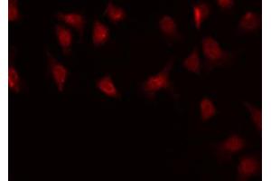 ABIN6268849 staining HuvEc by IF/ICC. (MKL1 抗体  (N-Term))