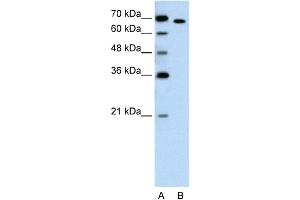 WB Suggested Anti-RORA Antibody Titration:  1. (RORA 抗体  (Middle Region))