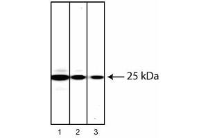 Western blot analysis of Rab27 in human chronic myelogenous leukemia. (RAB27A 抗体)