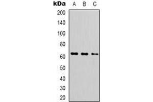Western blot analysis of FUBP3 expression in HEK293T (A), HepG2 (B), MCF7 (C) whole cell lysates.
