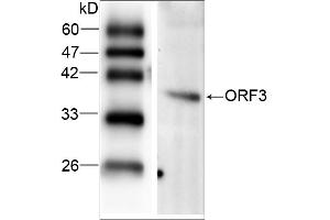 WB analysis of recombinant Hepatitis E virus ORF 3, using HEV ORF3 antibody. (HEV ORF3 抗体  (AA 34-123))