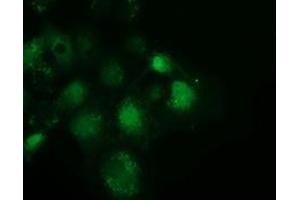 Anti-SPR mouse monoclonal antibody (ABIN2453684) immunofluorescent staining of COS7 cells transiently transfected by pCMV6-ENTRY SPR (RC205679). (SPR 抗体)