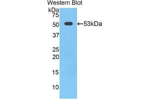 Western Blotting (WB) image for anti-Cathepsin K (CTSK) (AA 90-318) antibody (ABIN1858554) (Cathepsin K 抗体  (AA 90-318))