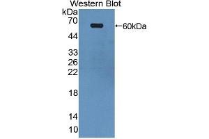 Detection of Recombinant EPHA4, Human using Polyclonal Antibody to Ephrin Type A Receptor 4 (EPHA4) (EPH Receptor A4 抗体  (AA 621-882))