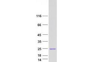 Western Blotting (WB) image for Heat Shock Protein Family B (Small), Member 11 (HSPB11) protein (Myc-DYKDDDDK Tag) (ABIN2723111)