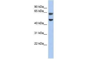 ZP1 antibody used at 1 ug/ml to detect target protein. (ZP1 抗体)