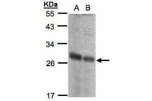 WB Image Sample(30 ug whole cell lysate) A:293T B:A431, 12% SDS PAGE antibody diluted at 1:1000 (NQO2 抗体  (Center))