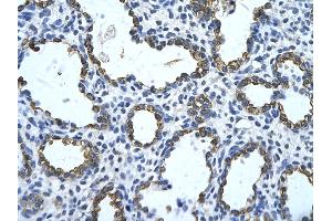 Rabbit Anti-GNAS Antibody       Paraffin Embedded Tissue:  Human alveolar cell   Cellular Data:  Epithelial cells of renal tubule  Antibody Concentration:   4. (GNAS 抗体  (N-Term))