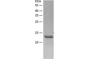 Western Blotting (WB) image for NudC Domain Containing 2 (NUDCD2) (AA 1-157) protein (His tag) (ABIN7124235) (NUDCD2 Protein (AA 1-157) (His tag))