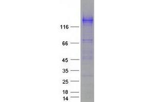Validation with Western Blot (SEZ6L Protein (Myc-DYKDDDDK Tag))
