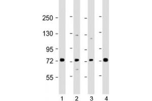 Western blot testing of human 1) Raji, 2) A549, 3) HL-60 and 4) K562 cell lysate with SKI antibody at 1:2000. (SKI 抗体  (AA 21-54))