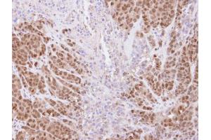 Immunohistochemistry (IHC) image for anti-Tripartite Motif Containing 21 (TRIM21) antibody (ABIN2856919)