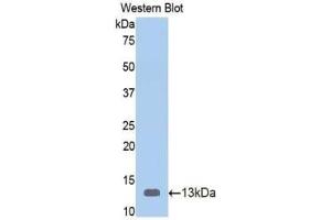 Western blot analysis of the recombinant protein. (Vitamin D-Binding Protein 抗体  (AA 395-475))
