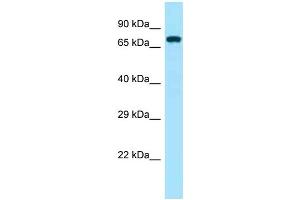 Western Blotting (WB) image for anti-zeta-Chain (TCR) Associated Protein Kinase 70kDa (ZAP70) (Middle Region) antibody (ABIN2788711) (ZAP70 抗体  (Middle Region))