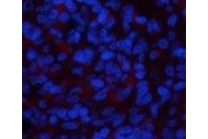 Immunofluorescence analysis of Rat spleen tissue using NBR1 Monoclonal Antibody at dilution of 1:200. (NBR1 抗体)