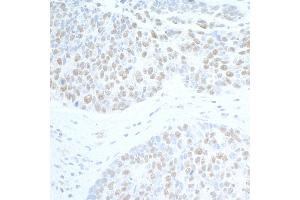 Immunohistochemistry (IHC) image for anti-Suppressor of Ty 6 Homolog (SUPT6H) (AA 425-475) antibody (ABIN7453850) (Spt6 抗体  (AA 425-475))