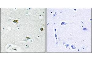 Immunohistochemistry analysis of paraffin-embedded human brain tissue, using BAD (Ab-91/128) Antibody. (BAD 抗体  (AA 61-110))
