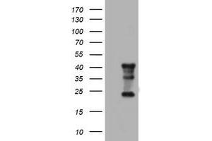 Image no. 8 for anti-Transmembrane Protein 173 (TMEM173) antibody (ABIN1501428) (STING/TMEM173 抗体)