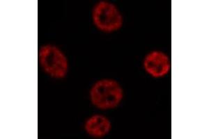 ABIN6269269 staining Hep G2 cells by IF/ICC. (SOX9 抗体)