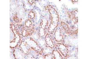 Immunohistochemistry (Paraffin-embedded Sections) (IHC (p)) image for anti-Glycine Amidinotransferase (L-Arginine:glycine Amidinotransferase) (GATM) antibody (ABIN7262473)