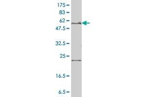 SLC27A4 monoclonal antibody (M01), clone 1F4-1B10 Western Blot analysis of SLC27A4 expression in HeLa .