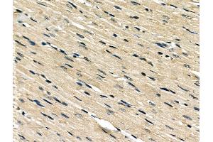 ABIN6260195 and ABIN6266499 at 1/100 staining Rat heart tissue by IHC-P.