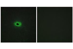 Immunofluorescence analysis of HeLa cells, using Syndecan4 (epitope around residue 179) antibody. (SDC4 抗体  (Ser179))