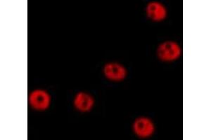 ABIN6278345 staining  Hela cells by IF/ICC. (RECQL2 抗体  (Internal Region))