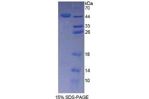 SDS-PAGE analysis of Human SPAG1 Protein.