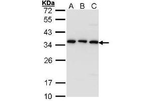 WB Image Sample (30 ug of whole cell lysate) A: A431 , B: H1299 C: Hela 12% SDS PAGE antibody diluted at 1:1000 (TBCB 抗体)