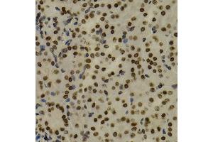 Immunohistochemistry of paraffin-embedded mouse kidney using NFKB2 antibody at dilution of 1:200 (400x lens). (NFKB2 抗体)