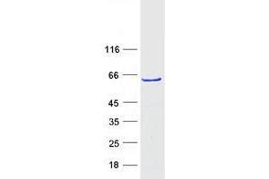 Western Blotting (WB) image for Zinc Finger Protein 213 (ZNF213) (Transcript Variant 1) protein (Myc-DYKDDDDK Tag) (ABIN2735958)
