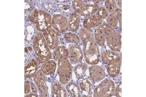 Immunohistochemical staining of human kidney with LHFPL2 polyclonal antibody  shows moderate cytoplasmic positivity in cells in tubules. (LHFPL2 抗体)