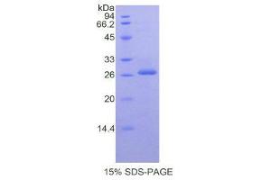 SDS-PAGE (SDS) image for Prostate Specific Antigen (PSA) (AA 39-261) protein (His tag) (ABIN1877792) (Prostate Specific Antigen Protein (PSA) (AA 39-261) (His tag))