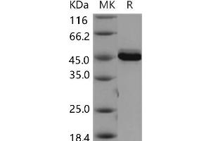 Western Blotting (WB) image for V-Akt Murine Thymoma Viral Oncogene Homolog 3 (Protein Kinase B, Gamma) (AKT3) (Active) protein (ABIN7319999) (AKT3 蛋白)